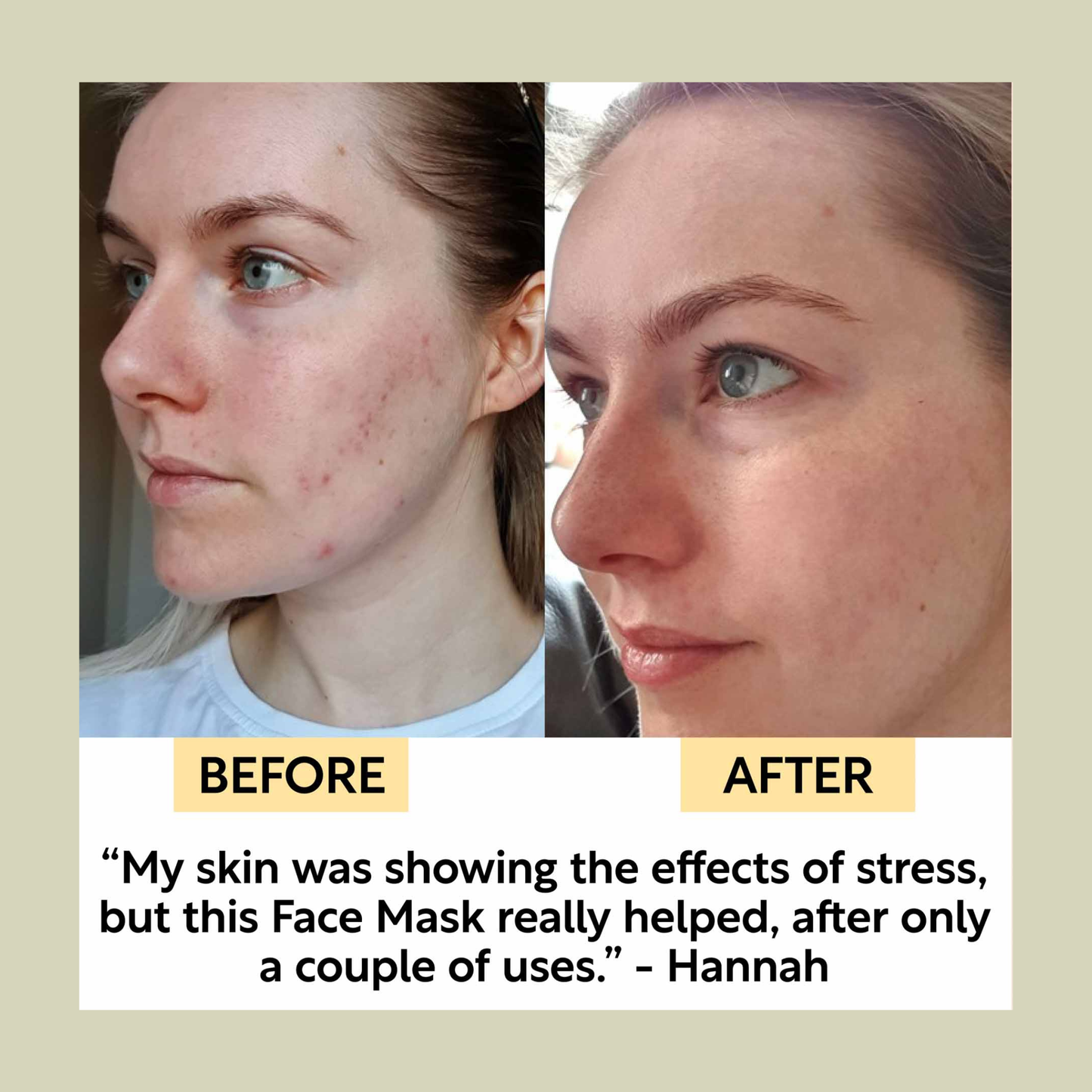 UpCircle Hydrating Kaolin Clay Face Mask Detoxifying Mask to Clear Spots, Blackheads and Pores 60ml