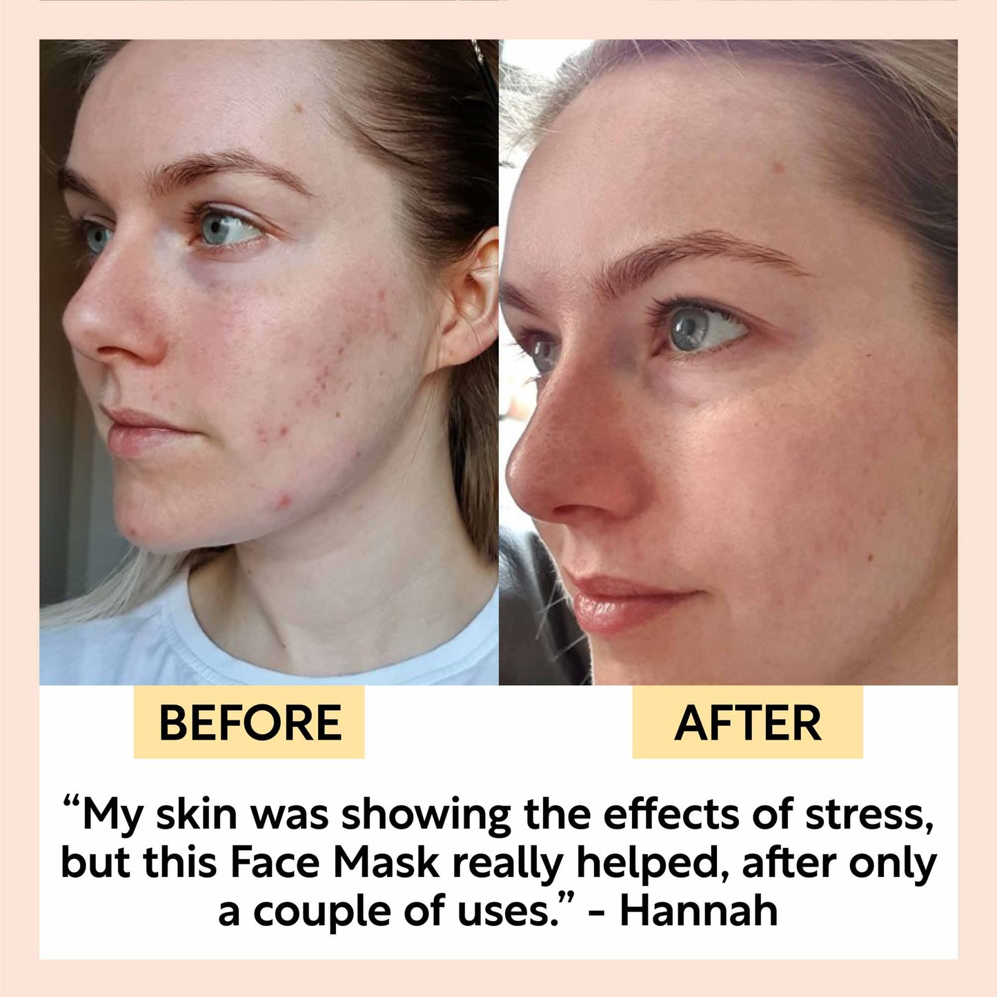 UpCircle Hydrating Kaolin Clay Face Mask Detoxifying Mask to Clear Spots, Blackheads and Pores 60ml